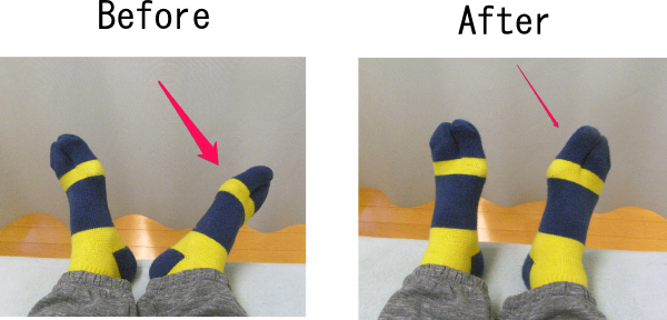 足の向きの変化